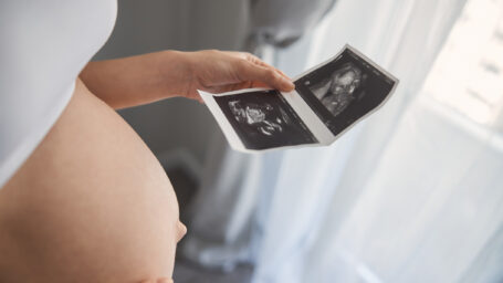 A pregnant woman looking at an ultrasound