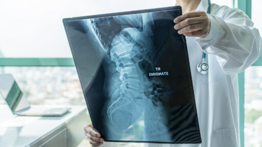 A doctor looking at an x-ray