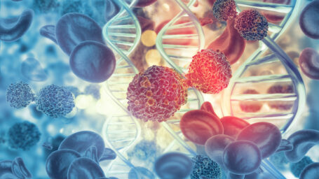 Cancer cells in a human body