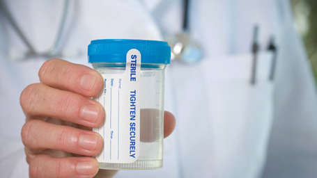 doctor with a urine sample