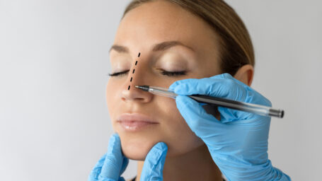 Beauty surgeon with blue gloves drawing marks on nose