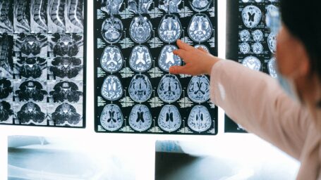 UAMS Neurology