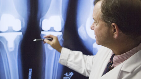 Dr. Barnes reviewing an X-ray of a joint