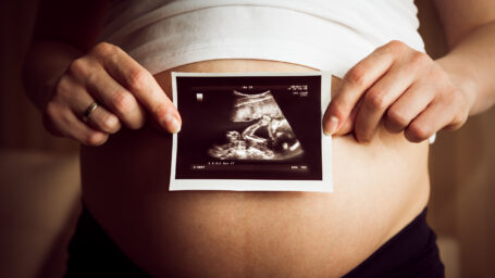 A shot of Pregnant Woman Holding Ultrasound Scan